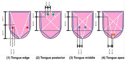 Combination Image Analysis of Tongue Color and Sublingual Vein Improves the Diagnostic Accuracy of Oketsu (Blood Stasis) in Kampo Medicine